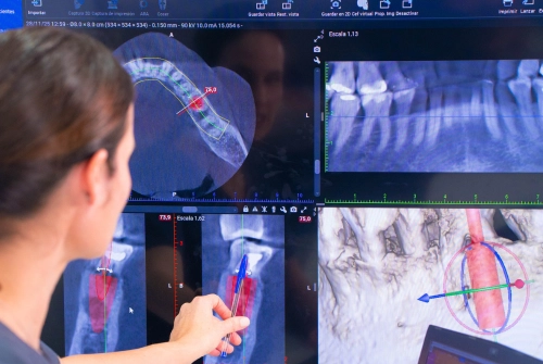 servicio implantologia dental